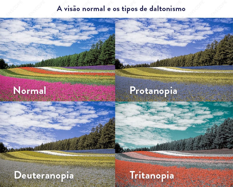 Imagem de uma criança com necessidades especiais